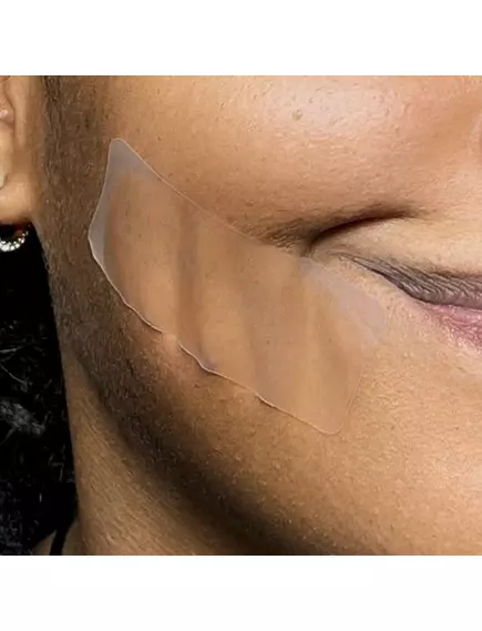 Patch Aid Pimple Patch XL by PatchAid / Патч від прищів XL 10 шт., фото 5 від магазину біодобавок nutrido.shop