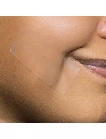 Patch Aid Pimple Patch XL by PatchAid / Патч від прищів XL 10 шт., фото 6 від магазину біодобавок nutrido.shop